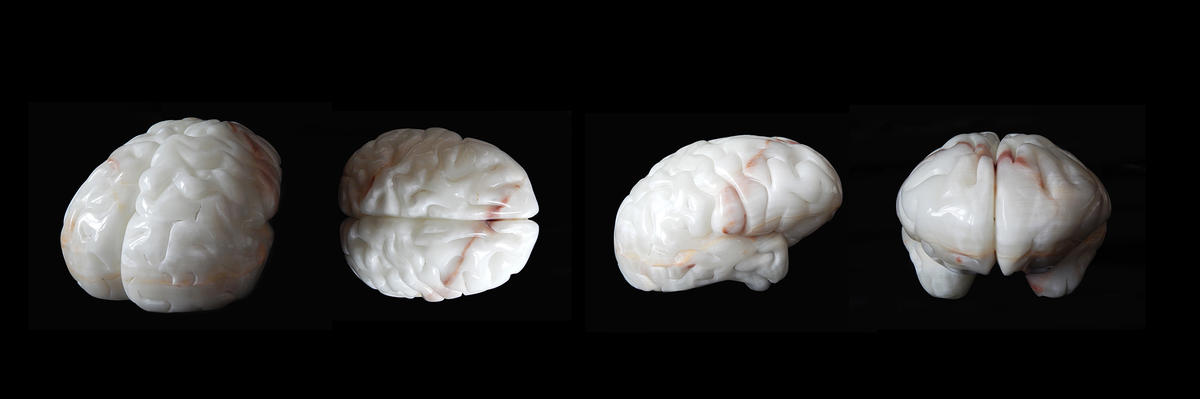 何汶玦作品《人脑的进化》